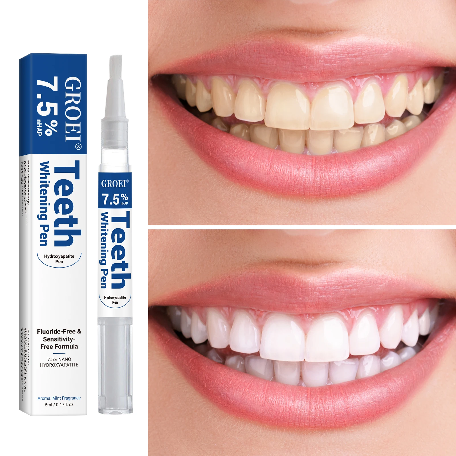 Hydroxyapatite Tooth Whitening - огляд і ціна Teeth Whitening Hydrogen Peroxide