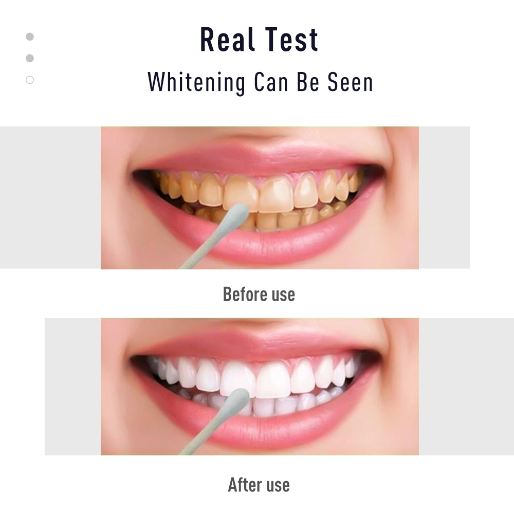 Pen Tooth Gel White  Kit Clean - огляд і ціна Whitening Pen Bleach