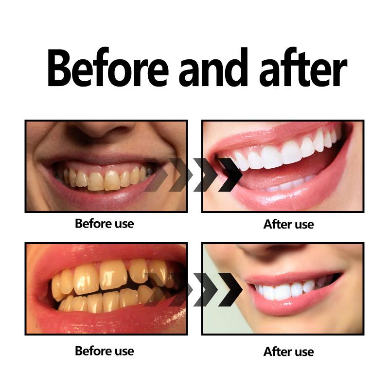 Teeth Whitening Powder Charcoa - огляд і ціна Teeth Whitening Charcoal Powder