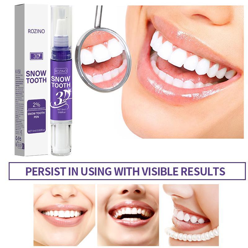 New Portable Teeth Whitening P - огляд і ціна Whitening Pen Bleach