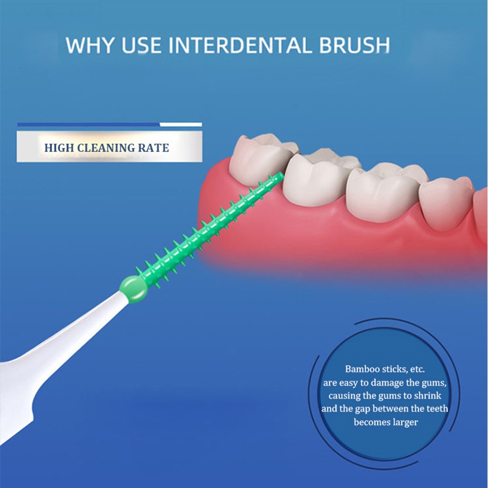40~150PCS Silicone Interdental - огляд і ціна Teeth Whitening For Braces