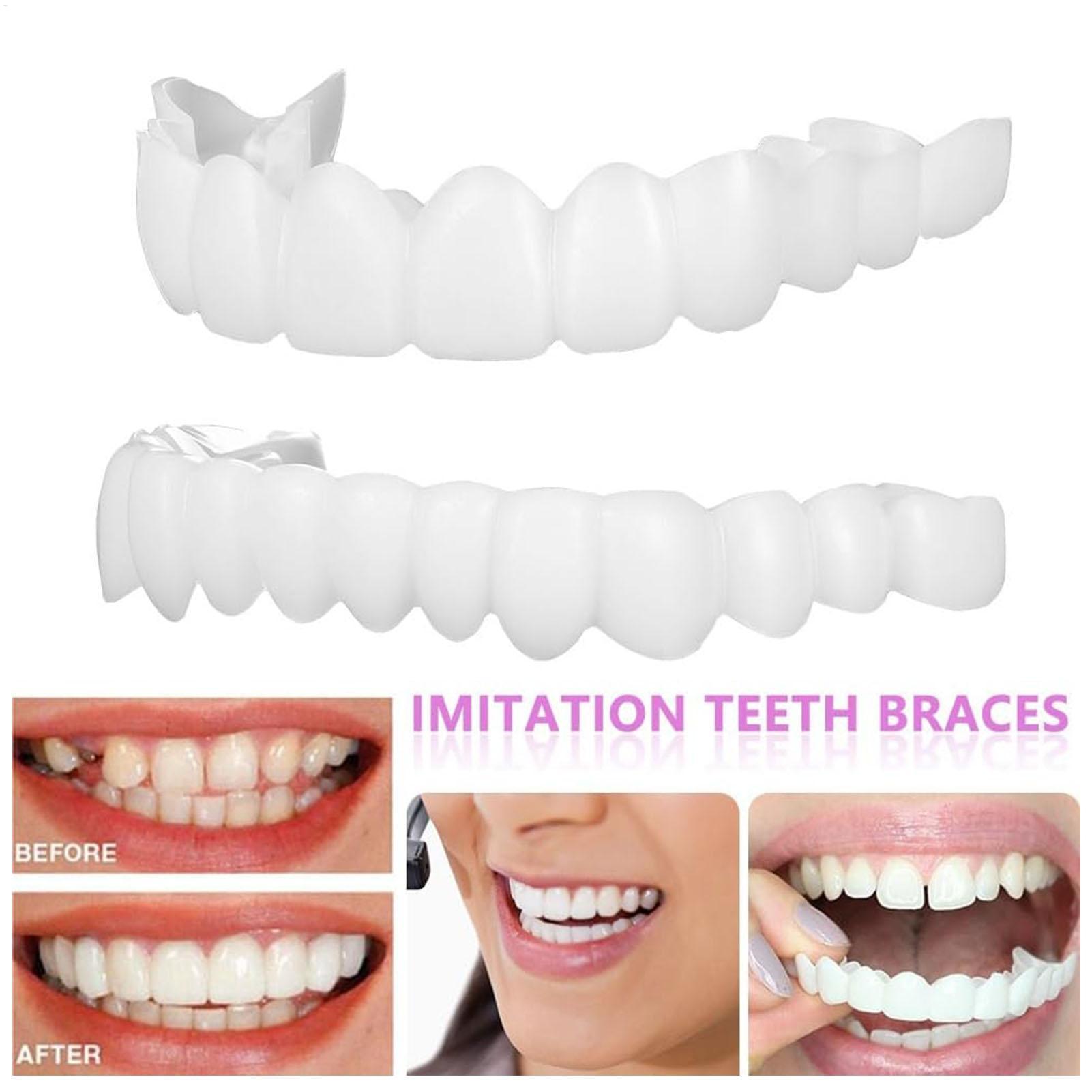 Dental Upper Lower Fake Teeth  - огляд і ціна Teeth Whitening For Braces
