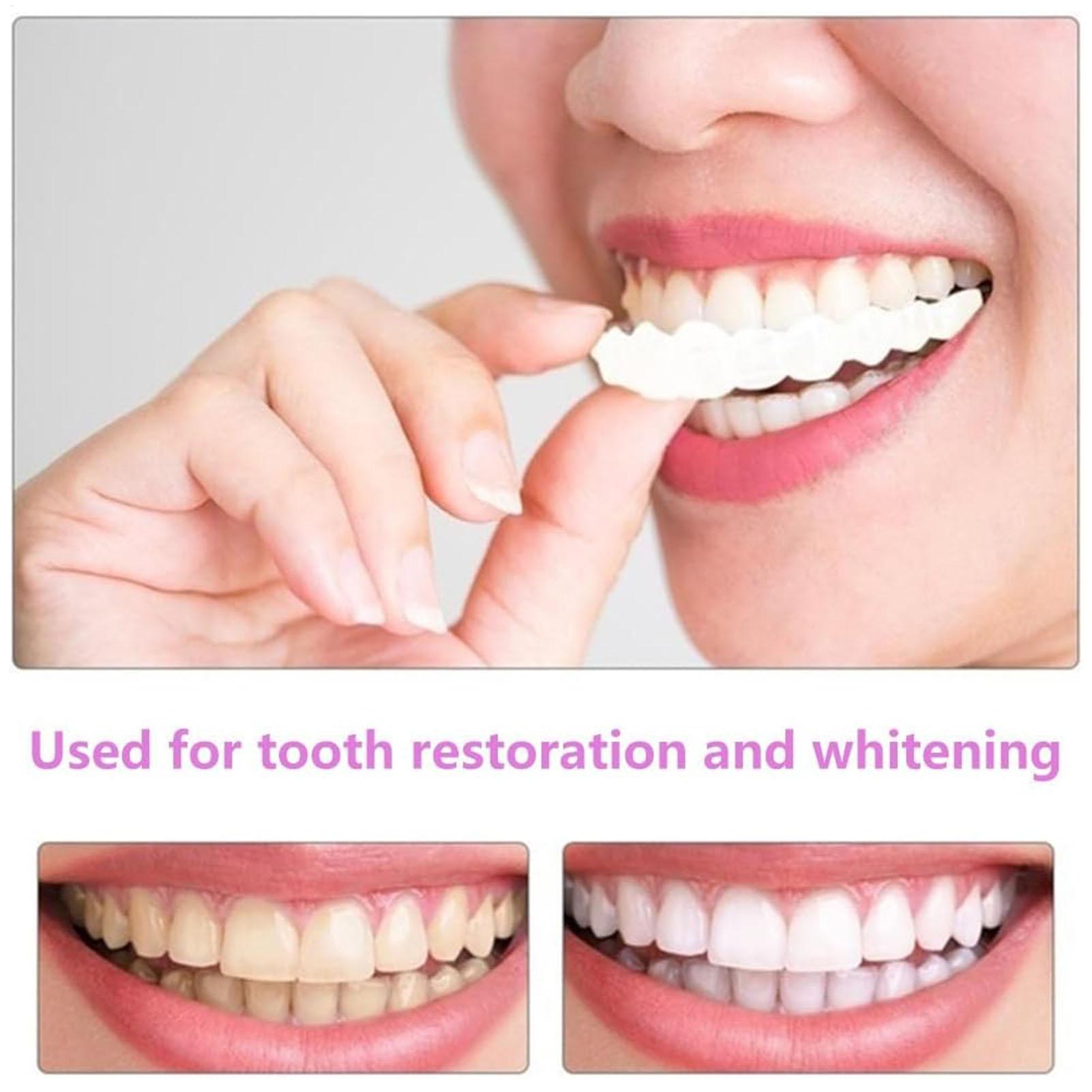 Dental Upper Lower Fake Teeth  - огляд і ціна Teeth Whitening For Braces