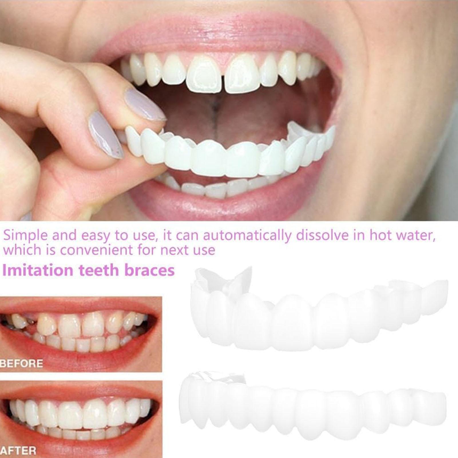 Dental Upper Lower Fake Teeth  - огляд і ціна Teeth Whitening For Braces