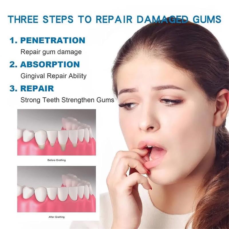 Gum Repair Care Serum Relieve  - огляд і ціна Teeth Whitening Gingival Barrier