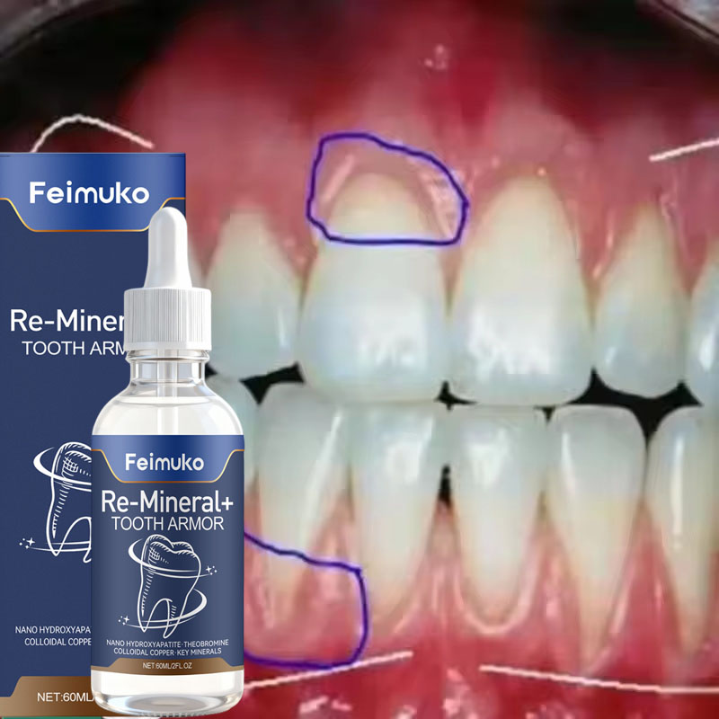 Gum Repair Care Serum Relieve  - огляд і ціна Teeth Whitening Gingival Barrier