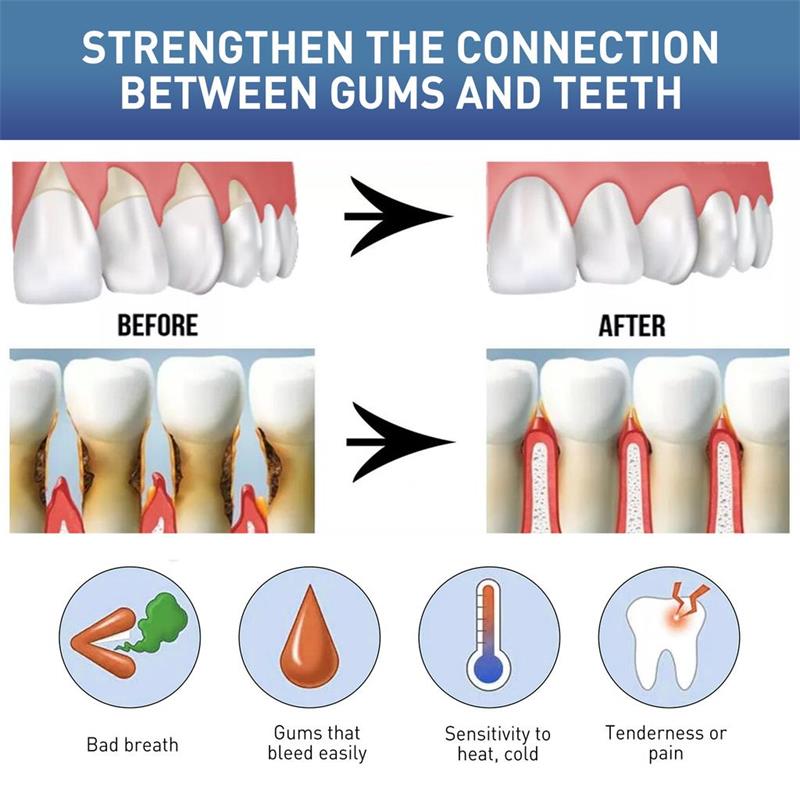 Gum Repair Care Serum Relieve  - огляд і ціна Teeth Whitening Gingival Barrier