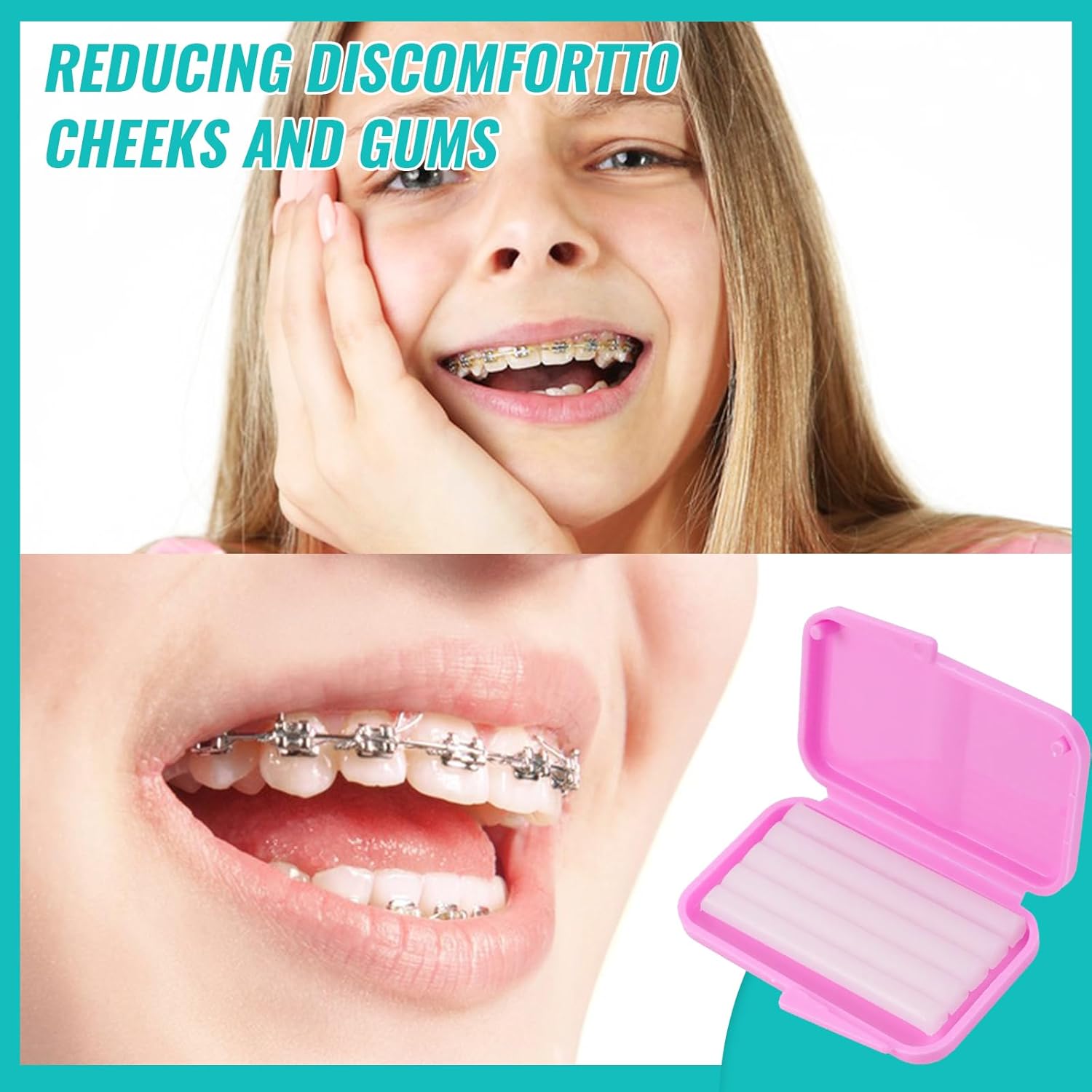 10box Dental Orthodontic Relie - огляд і ціна Teeth Whitening For Braces
