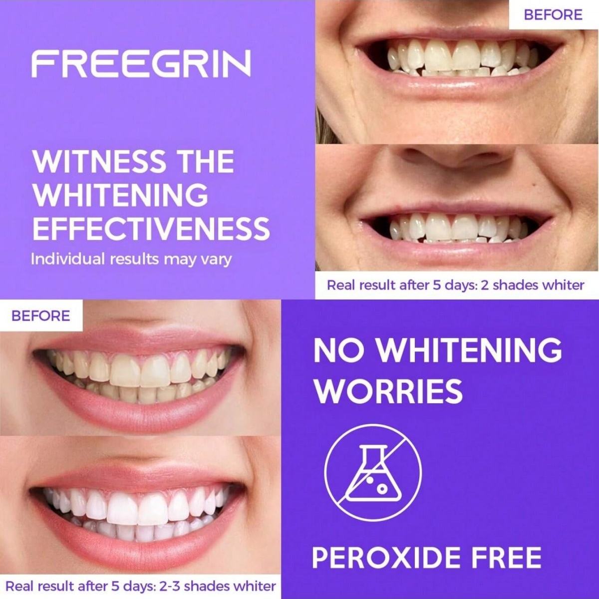 Deluxe Whitening Teeth Sticker - огляд і ціна Teeth Whitening Quotes