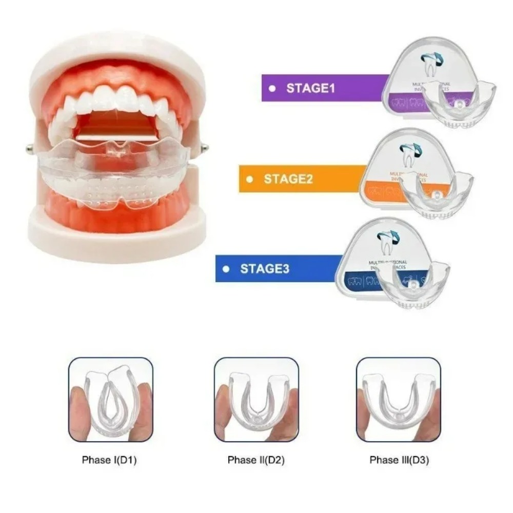 Orthodontic Brace Straightener - огляд і ціна Teeth Whitening For Braces