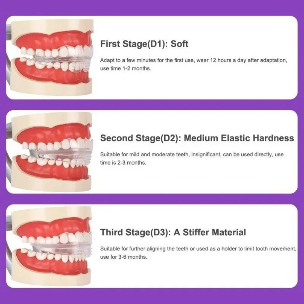 Orthodontic Brace Straightener - огляд і ціна Teeth Whitening For Braces